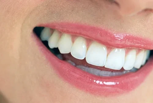 estetik-dolgu-2